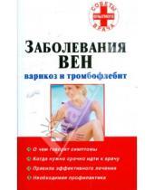 Картинка к книге Советы опытного врача - Заболевания вен: варикоз и тромбофлебит