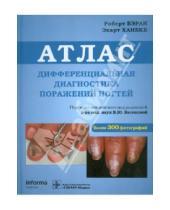 Картинка к книге Экарт Ханеке Роберт, Бэран - Дифференциальная диагностика поражений ногтей. Атлас