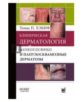 Картинка к книге П. Томас Хэбиф - Клиническая дерматология. Акнеподобные и папулосквамозные дерматозы