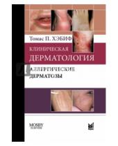 Картинка к книге П. Томас Хэбиф - Клиническая дерматология. Аллергические дерматозы