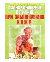 Картинка к книге Владимир Преображенский - Полное очищение и лечение при заболеваниях кожи