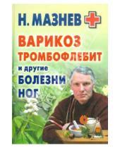 Картинка к книге Иванович Николай Мазнев - Варикоз, тромбофлебит и другие болезни ног
