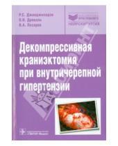 Картинка к книге ГЭОТАР-Медиа - Декомпрессивная краниэктомия при внутричерепной гипертензии